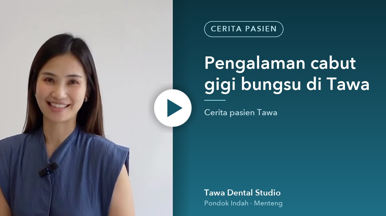 Cover video: Pengalaman cabut gigi bungsu di Tawa