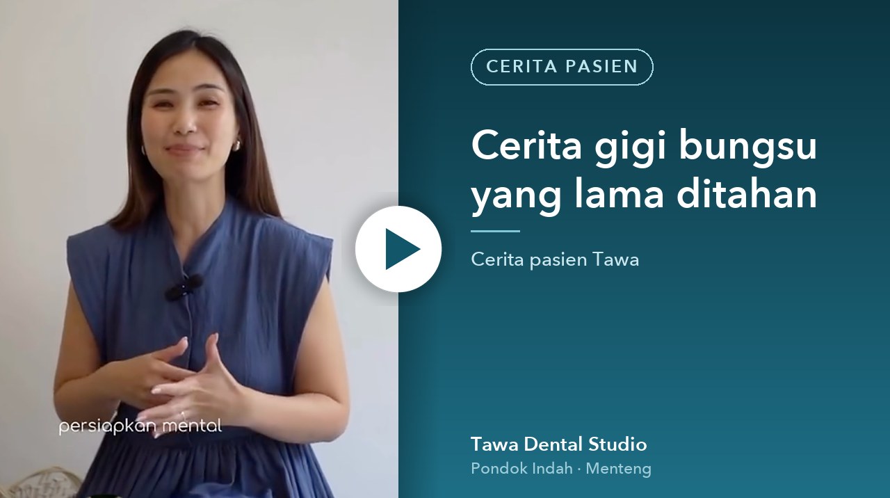 Cover video: Cerita gigi bungsu yang lama ditahan