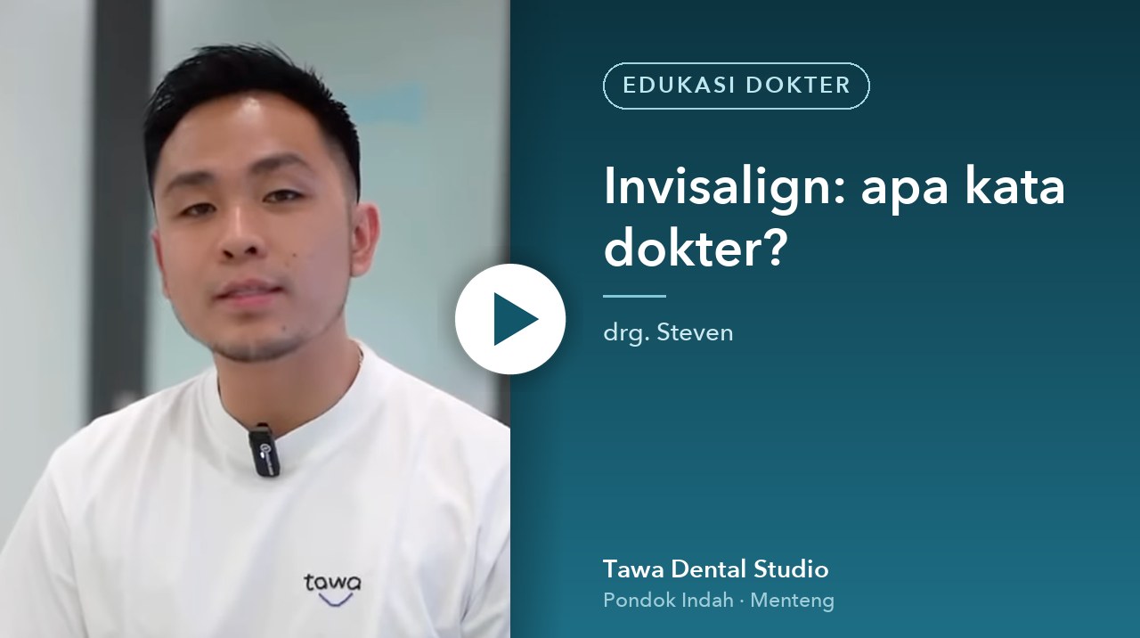Cover video: Invisalign: apa kata dokter?