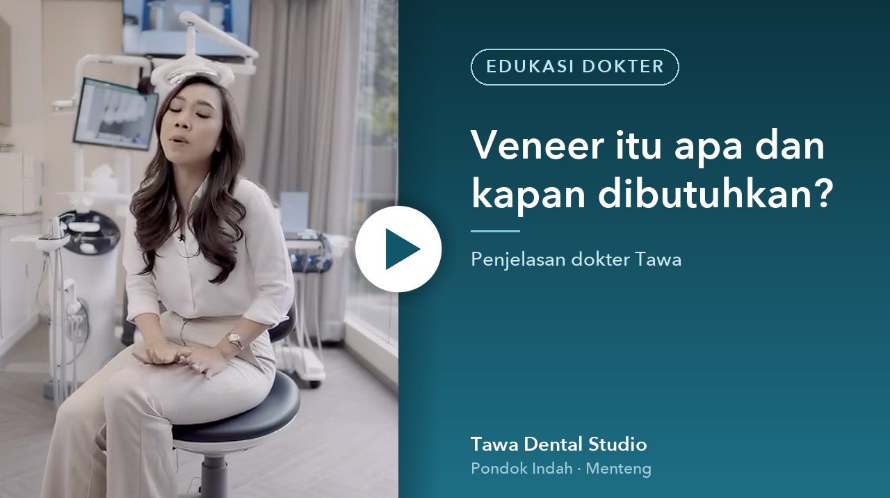 Cover video: Veneer itu apa dan kapan dibutuhkan?