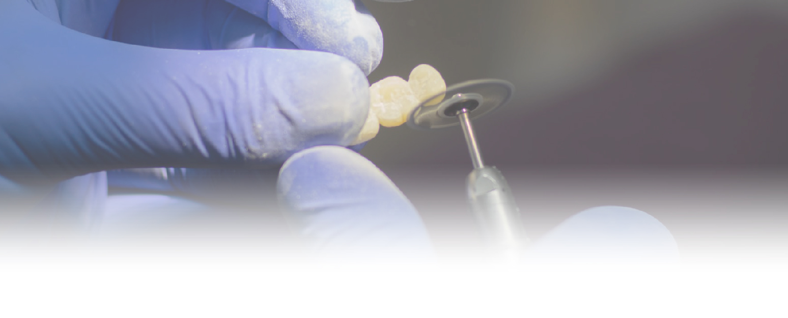 Implan Gigi (Dental Implant) — Tawa Dental Studio